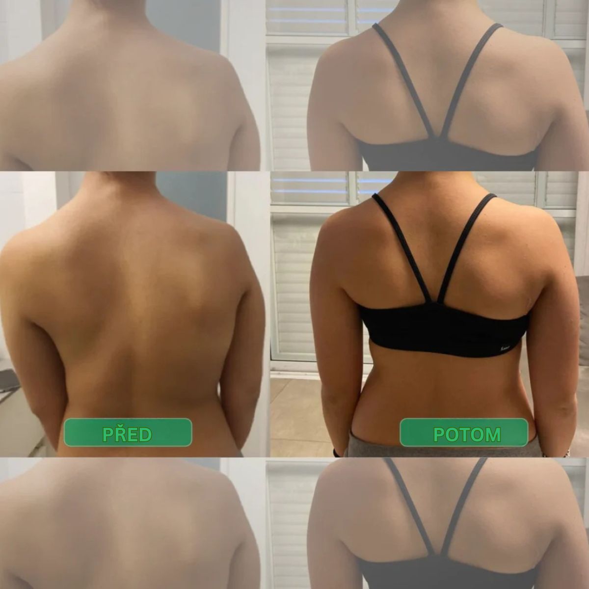 Okamžitý korektor držení těla – Postavte se rovně. Ulevte svým zádům. Poznejte rozdíl hned od prvního dne