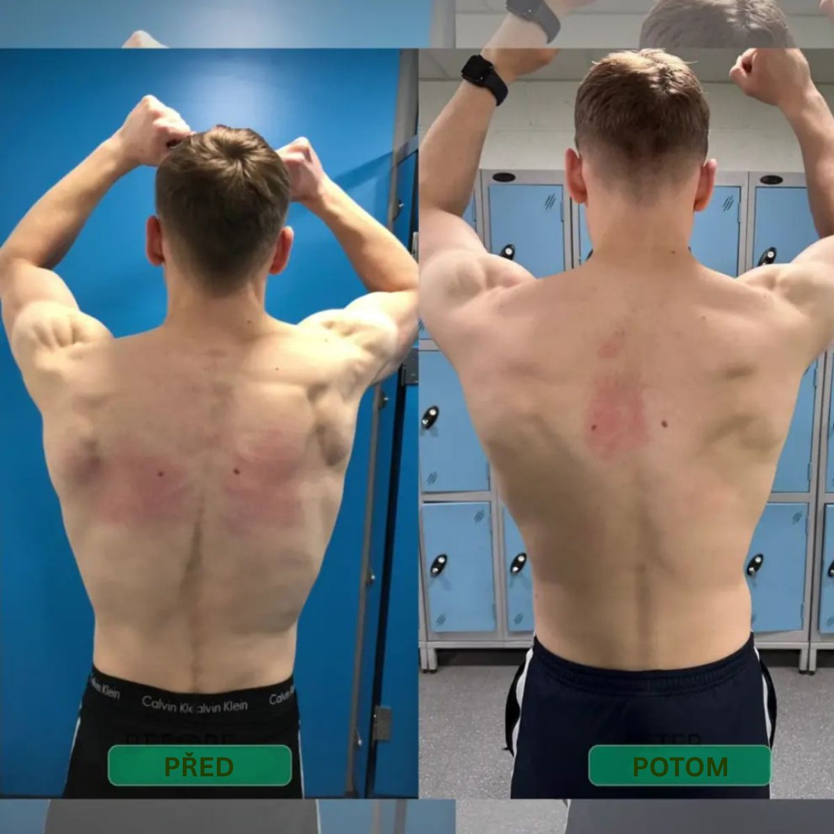 Okamžitý korektor držení těla – Postavte se rovně. Ulevte svým zádům. Poznejte rozdíl hned od prvního dne