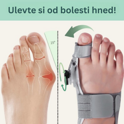 Léčebný balíček pro vbočený palec (Hallux Valgus)