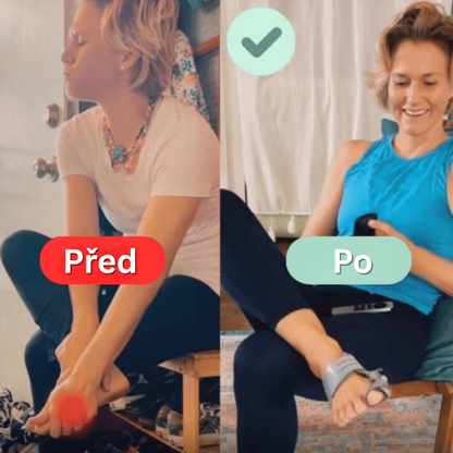 Léčebný balíček pro vbočený palec (Hallux Valgus)
