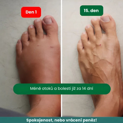 Zenstride® Prodyšné kompresní ponožky pro nohy a chodidla bez bolesti